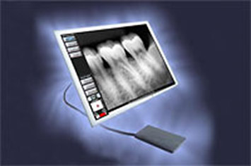 Digital X-rays